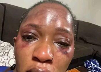 Victime de violences conjugales, la chanteuse célèbre Djelykaba Bintou n’en peut plus !