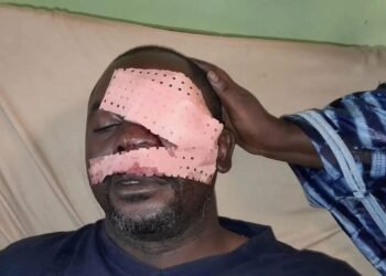 Bomboly : un journaliste de la RTG agressé par des manifestants