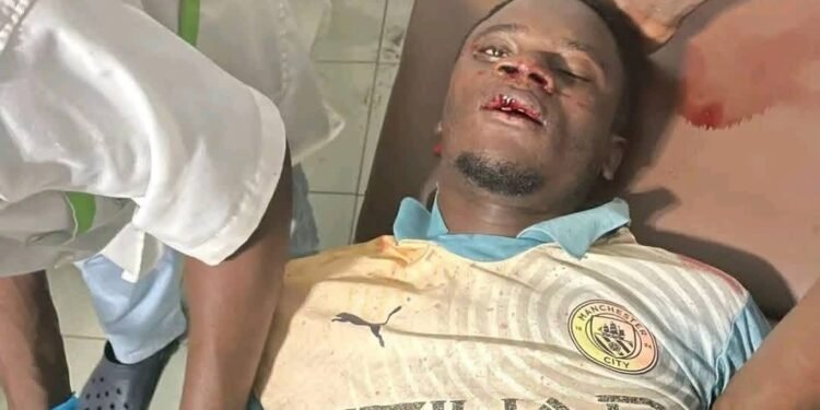 Urgent – Conakry : un homme grièvement blessé dans un accident à Bambéto